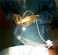 laparoscopic_surgery_faq